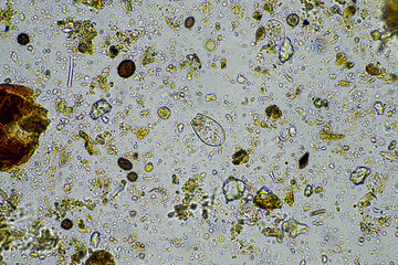 agronomist with a soil sample with soil life and bugs. microorganisms storing carbon with fungi and...