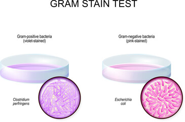 Gram stain test. glass Petri dish with culture Gram-negative and Gram-negative bacteria