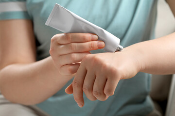 Woman applying ointment from tube onto her wrist, closeup