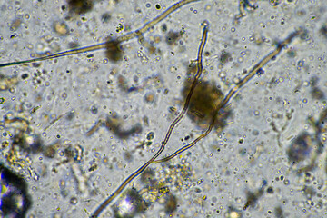 fungal hyphae and soil fungi in a soil sample, showing the living soil
