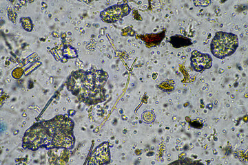 fungal hyphae and soil fungi in a soil sample, showing the living soil