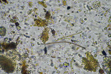 fungal hyphae and soil fungi in a soil sample, showing the living soil