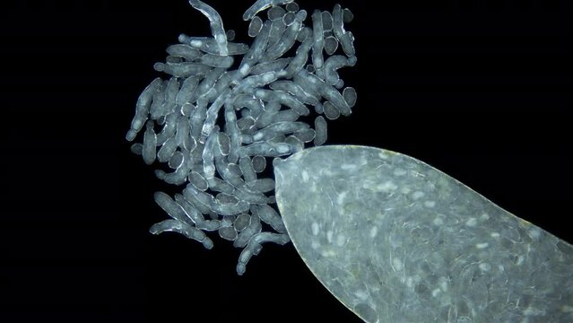 Sporocyst stage of parasitic worm Podocotyle sp. under a microscope, family Opecoelidae. Cercaria larvae emerge through maternity pore. Mollusca host. White Sea