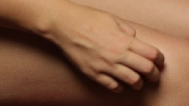 gros plan sur la jambe d'une personne se grattant la peau  apr&egrave;s une piqure d'insecte