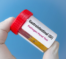 Stool sample for Gastrointestinal (GI) pathogens panel test for Giardiasis disease diagnosis.
