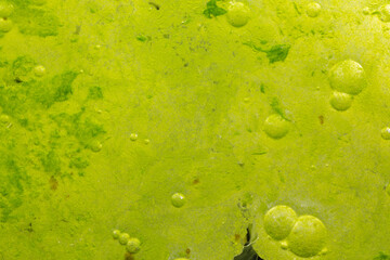 Cyanobacteria, Cyanobacteriota or Cyanophyta a layer on the water surface, water pollution,  micro photography under microscope
