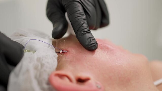 The cosmetologist pierces the face screen with a syringe to thread the threads