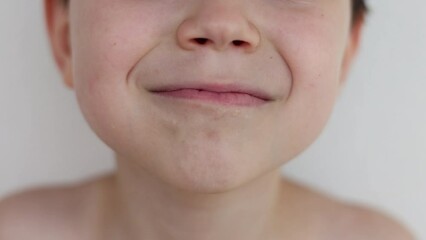 smiling kid child open mouth, tooth is falling, permanent raised from back.bloody teeth in front close up 
