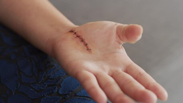 hand cut and stitches