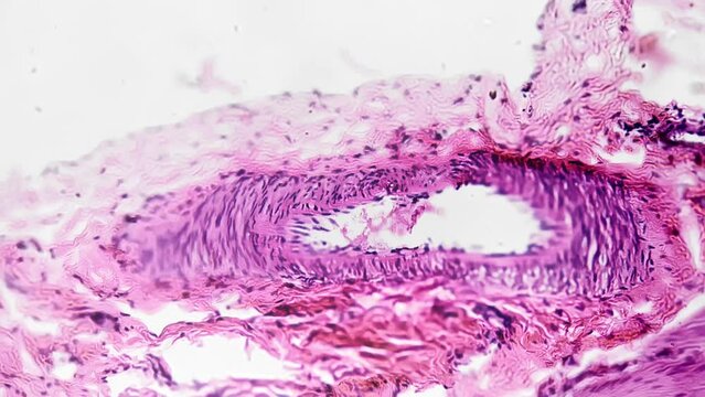 Bladder of human being in section filmed under microscope 200x for medical analysis on bright field. Sample of organ in people that stores urine from the kidneys. Study different parts of body in lab.