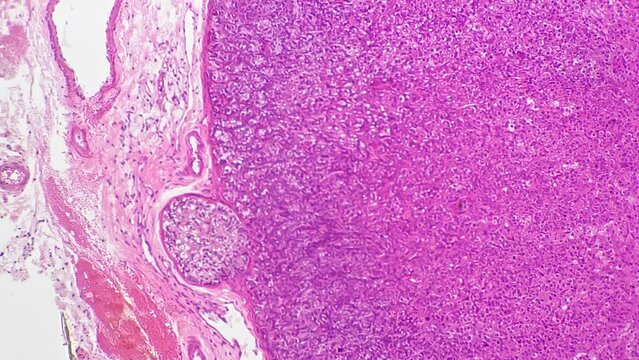 Section of human adrenal gland filmed under microscope with 200 times magnification on white background. Macro view of man organ showing different layers of cells. Producing steroid hormones theme