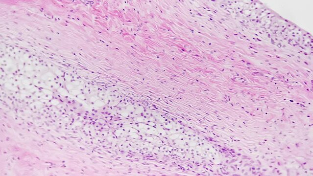 Section of man transitional epithelium filmed under microscope 200x on bright field. Isolated macro of tissue consisting of multiple layers of cells. Discovering body parts with high magnification