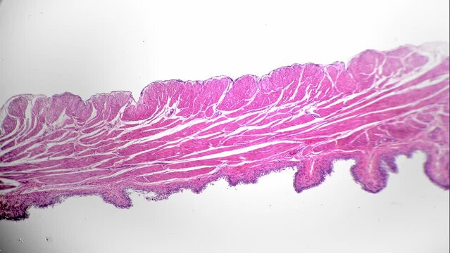 Isolated macro slide of human bladder sample in section magnified in 40 times under light micrograph. View of piece of people organ storing urine in void condition. Looking for infection in the lab