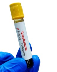 Blood sample for Toxoplasma test