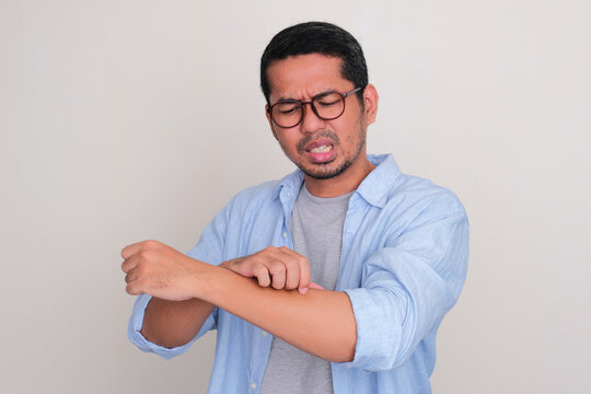Adult Asian man scratching his hand and showing uncomfortable expression