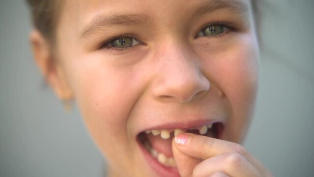 The girl touches her front baby tooth, which is loose. Close-up