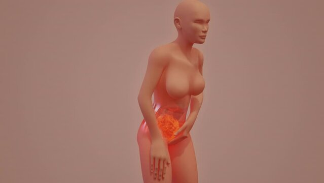 Menstruation pain 3D visualization of semitransparent woman body gestures and pain spot