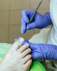 Rolgordijnen A close-up of the process of making a pedicure by a master. Foot care in medical centers. Professional medical pedicure procedure while doctor using nail instrument. Treatment of the skin of the foot  © ANASTASIIA