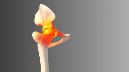  Medical concept of a painful hip in a human - obrazy, fototapety, plakaty
