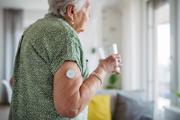 Diabetic senior patient using continuous glucose monitor to check blood sugar level at home.