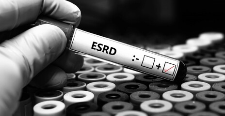 Blood sample of patient positive test for ESRD.