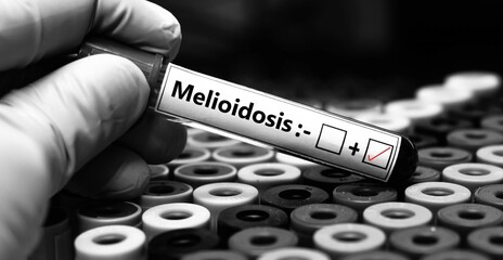 Blood sample of patient positive test for melioidosis.