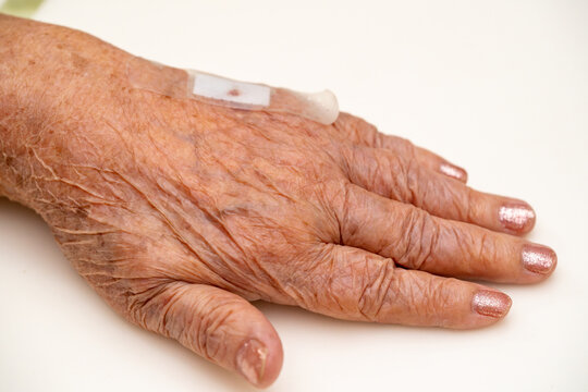 Close up old woman hand, upper limb or arm to the wounded waiting for nurse treatment on wound dressing a bloody and brine of patient on white background.