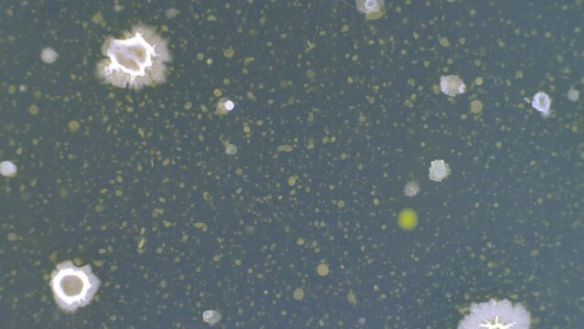 time lapse of growth of pathogenic bacteria on agar in a Petri dish