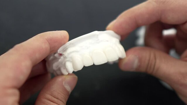 Cceramic dental veneers shown by the hands of the dentist. on back background