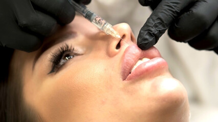 A beautician in medical gloves carefully and slowly injects hyaluronic acid into the lips of a young woman with a syringe. lip augmentation procedure. beauty injections. - obrazy, fototapety, plakaty