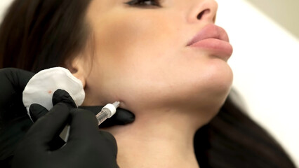 A cosmetologist makes multiple injections of biorevitalization with hyaluronic acid into the skin...