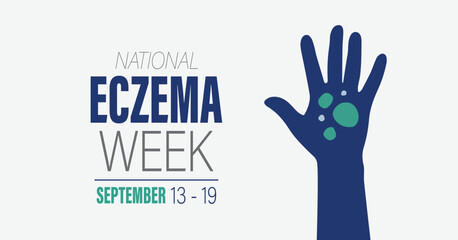 National Eczema Week. September 13 - 19, 2023 vector awareness campaign banner.