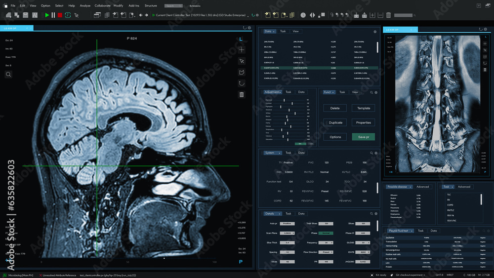 Aufkleber 3D Render: Magnetic Resonance Imaging Brain and Spinal Cord Scan Mock-up with Multiple Windows and Data. Medical Research Software Template with MRI Results for Computer Displays and Laptop Screens.