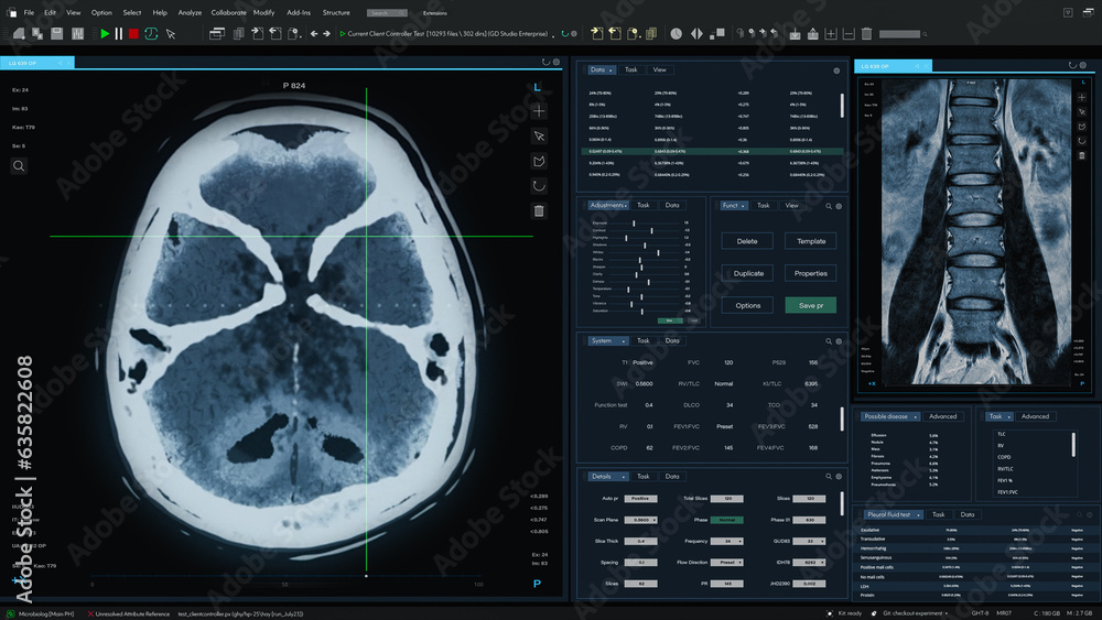 Aufkleber 3D Render: Magnetic Resonance Imaging Brain and Spinal Cord Scan Mock-up with Multiple Windows and Data. Medical Research Software Template with MRI Results for Computer Displays and Laptop Screens.