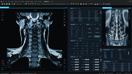 3D Render: Magnetic Resonance Imaging Spinal Cord Scan Mock-up with Multiple Windows and Data. Professional Medical Research Software Template with MRI Results for Computer Displays and Laptop Screens