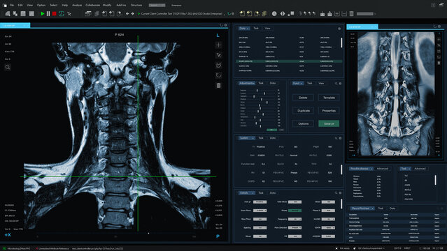 3D Render: Magnetic Resonance Imaging Spinal Cord Scan Mock-up with Multiple Windows and Data. Professional Medical Research Software Template with MRI Results for Computer Displays and Laptop Screens