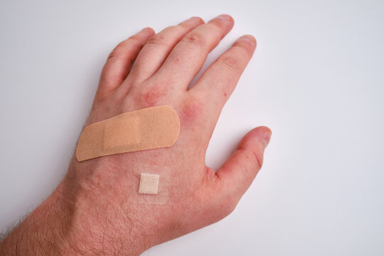 Male hand with a medical adhesive plaster close-up. Adhesive plaster on damaged skin. First aid for wounds and cuts