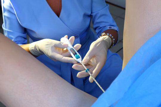 Contraceptive IUD. Installation of a birth control system. The gynecologist installs an IUD. Gynecological chair. An intrauterine contraceptive device with a copper coil used for contraception.
