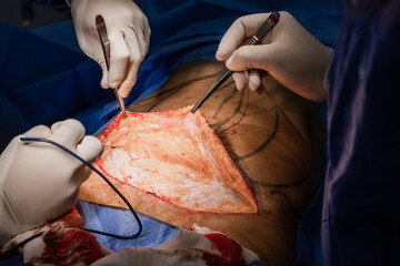 Crop doctor using professional tools for surgery