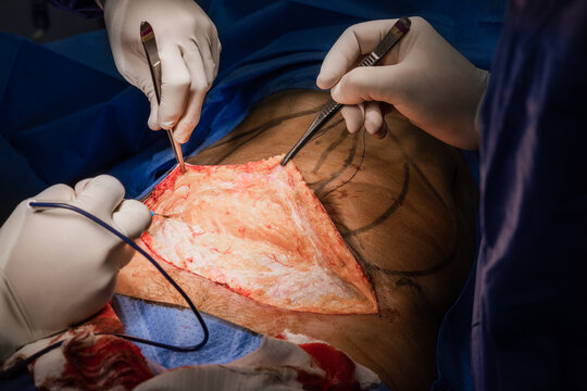 Crop doctor using professional tools for surgery