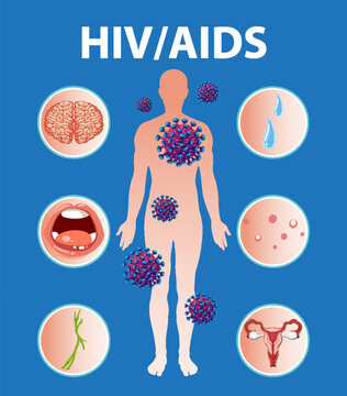 HIV/AIDS Virus: Effects on Immune System and Body