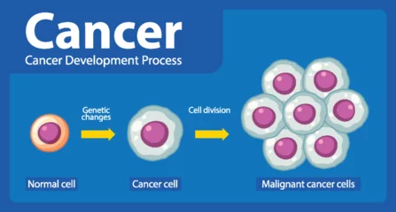 Fototapete Kinder Processing of Cancer Cells: An Infographic Exploration