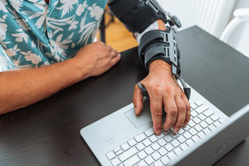 Man with adjustable articulated elbow orthosis typing on laptop keyboard