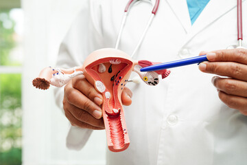 Uterus, doctor holding anatomy model for study diagnosis and treatment in hospital.