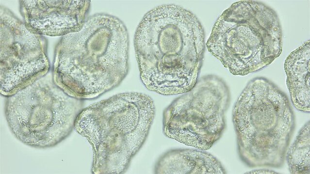 Larvae sea urchin Strongylocentrotus pallidus under microscope, phylum Echinodermata. Prism stage. White sea