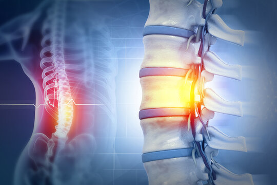 Human spinal cord injury, back pain on blurred background. 3d illustration