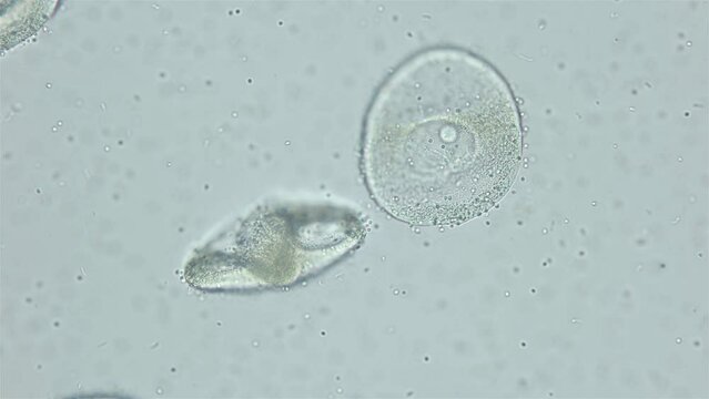 Sperm and ovule of worm Polychaeta Ophelia limacina under microscope, Opheliidae family. You can see movement of spermatozoa, that attach to egg for fertilization. White sea