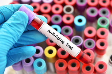 Obraz premium Test tube with blood sample for anti-aging test 
