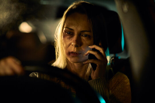 A young Caucasian woman, bearing the distressing signs of domestic abuse with prominent bruises and blackened eyes, speaks on her phone as she navigates her car through the nighttime streets.
