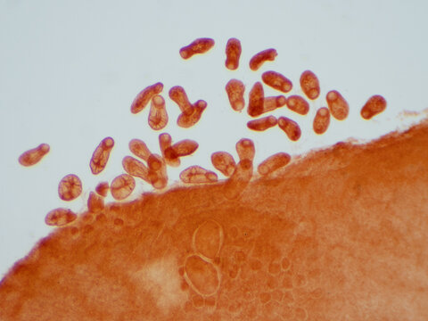 Fluke(Parasitic flatworm) of cattle and other grazing animals.